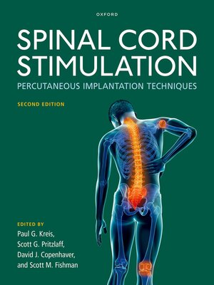 cover image of Spinal Cord Stimulation